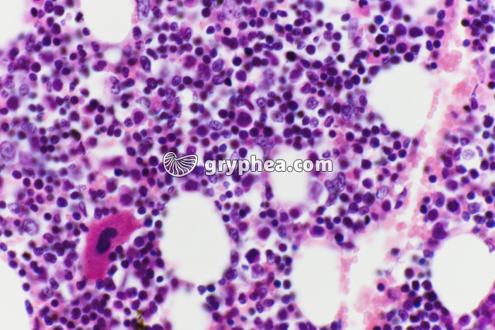 Moëlle osseuse in situ x200 - gryphea.com